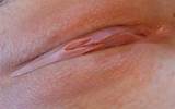 Female Pussy Vulva waxed