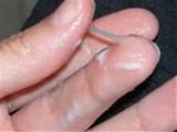 Transitional Cervical Mucus --- Also called 