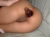 Extreme Anal Insertion Picture