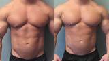 Displaying 20> Images For - Bodybuilders On Steroids Side Effects...
