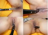 knife in pussy bizarre insertions knife in pussy bizarre insertions