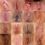 beautiful-labia:Different types of labia etc.Follow, submit and ask ...