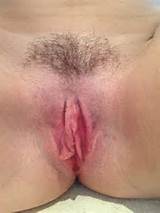 unhappy and very conscious about the way my vagina looks and how big ...