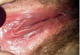More Hot Pictures From Virgin Pussy Rate My Naughty