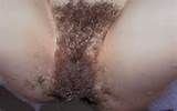 ... hairy dressed undressed porn hairy pussy naked hairy fever pussy and