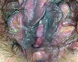 ... com/wp-content/gallery/blue-waffle-pictures/Blue-Waffle-Pictures-5.jpg