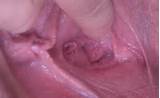 MATURE PUSSY [STRETCHED OPEN] - 49074619.JPG